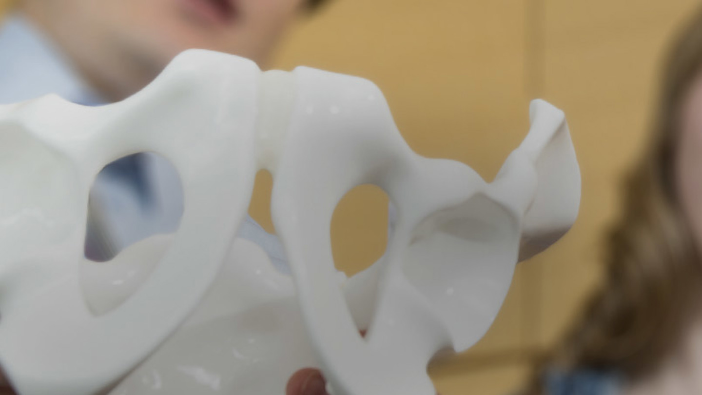In the background, a patient with long brown hair watches as a doctor holds a white plastic skeleton of the hips, which is shown clearly in the foreground.